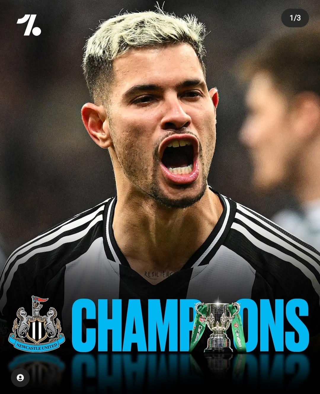 关于今夜社区盾焦点战,纽卡斯尔回应争议,信心回归,年轻球员得到机会的信息 关于今夜社区盾焦点战,纽卡斯尔回应争议,信心回归,年轻球员得到机会的信息